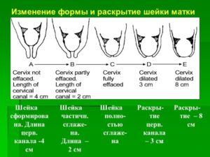 Короткая и мягкая шейка