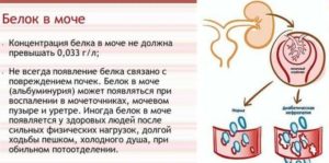 Диета при беременности при повышенном белке в моче