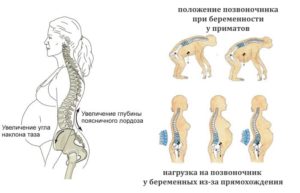 При беременности болят лобковые кости