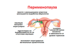 Начало климакса симптомы месячные