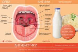 При беременности насморк и болит горло чем лечить