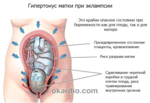 При беременности матка сжимается