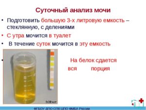 Суточный анализ мочи как собирать при беременности