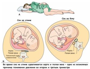 Безопасные позы при беременности во втором триместре