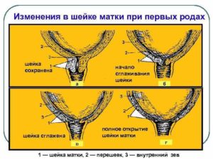 Сглажена шейка что значит