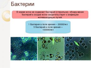 В моче нашли бактерии при беременности