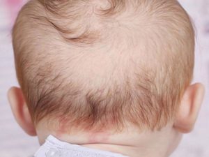 Волосы выпадают у месячного ребенка