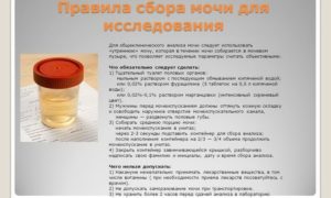 Перед сдачей анализа мочи