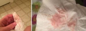 После родов розовые выделения