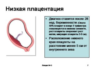 21 неделя низкая плацентация