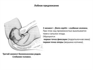 При лобном предлежании доношенного плода родоразрешение проводят