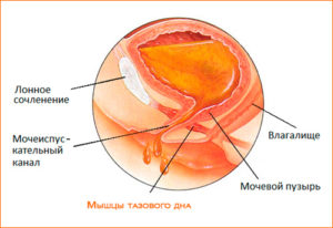 Мочевой пузырь после родов ослаб
