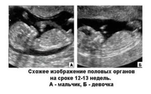 Можно узнать пол ребенка на 12 недели беременности