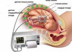 На какой неделе можно прослушать сердцебиение плода стетоскопом