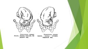 Головное предлежание плода 1 позиция передний вид