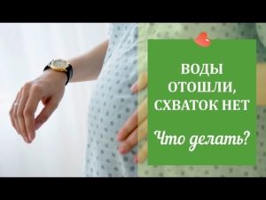 Отходят воды без схваток