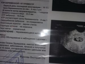 На каком сроке беременности можно делать первое узи