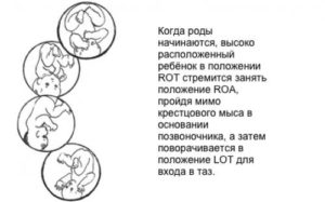 Как понять в каком положении ребенок в животе