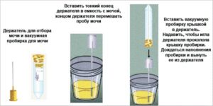 Зачем сдавать мочу беременным