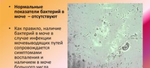Бактерии в моче у беременной что это значит