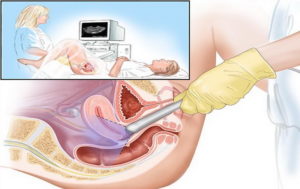 Можно ли пользоваться вибратором во время беременности
