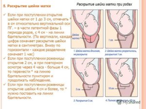 Шейка матки к родам готова