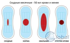 Скудные месячные на фемостоне