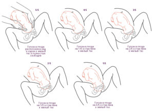При беременности головка низко