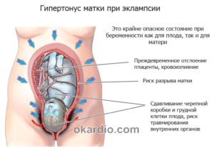 Тонус матки по задней стенке при беременности лечение