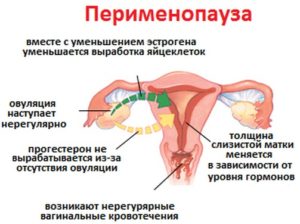 Месячные при наступлении менопаузы