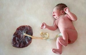 Сонник ребенок в плаценте