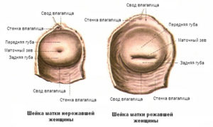 Цвет шейки матки при беременности