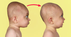 Почему у новорожденных большая голова