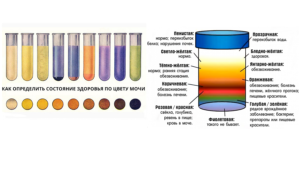 Какой цвет мочи при беременности на ранних сроках