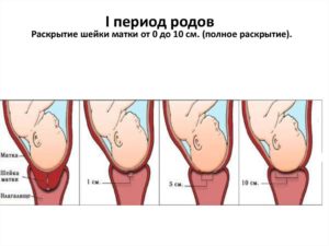 На сколько пальцев должна раскрыться матка при родах