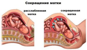 При беременности матка сжимается