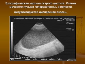 Мелкодисперсной взвесью что это