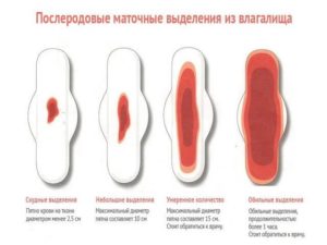 Кровяные выделения после кесарева сечения через 2 месяца