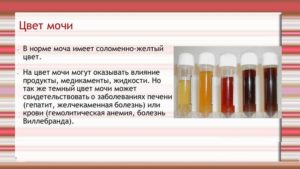У ребенка темная моча причины