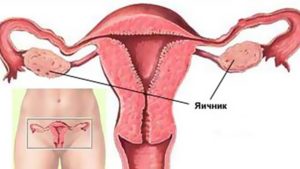 Болит яичник после овуляции