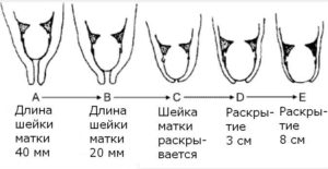 Состояние матки при беременности