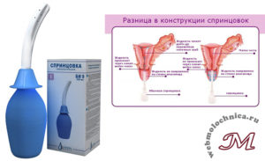 Можно ли беременным спринцеваться