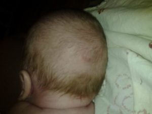 Когда у новорожденного выпадают волосы