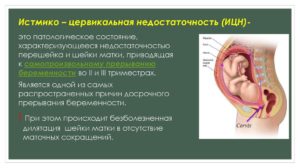 Но шпа при ицн