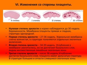 Созревание плаценты 2 степени на 32 неделе беременности