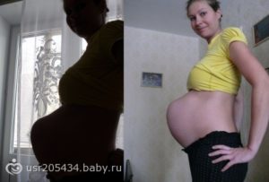 Шевеления на 20 неделе беременности внизу живота