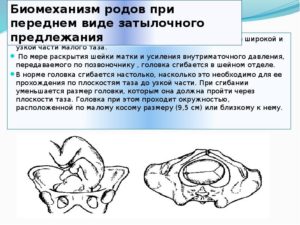 Головка прорезывается при переднем виде затылочного предлежания