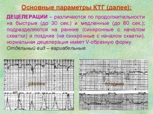 При ктг 1 децелерация