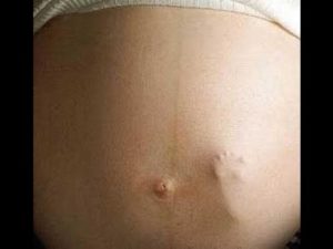 Ощущение шевеления в животе без беременности после месячных