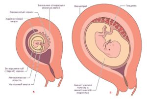 Что такое хорион по передней стенке при беременности